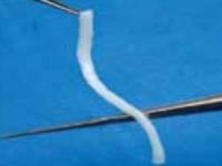 Avance processed nerve allograft - image from Axogen